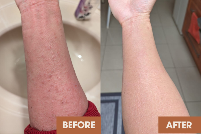 Client skin transformation